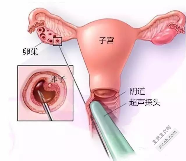 试管婴儿是否有年龄限制，48岁、58岁甚至60岁还能生孩子吗？