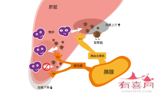 是什么导致了高胰岛素水平？