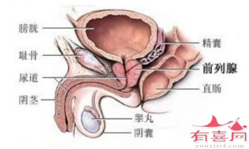 做试管婴儿可以报医保吗-前列腺肥大的人可以做试管婴儿吗？